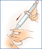 Imagen de una sonda de alimentación